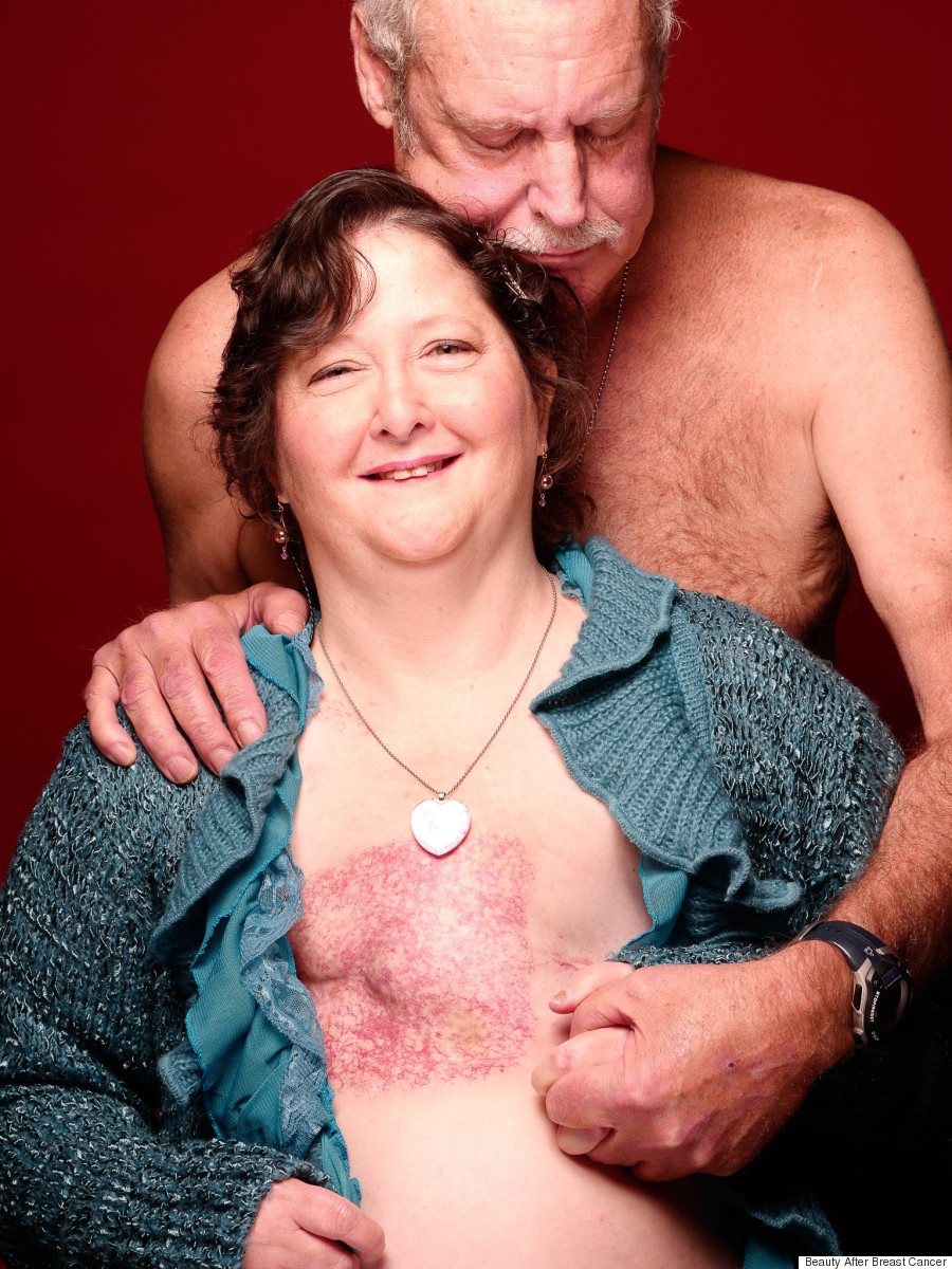 beauty after breast cancer